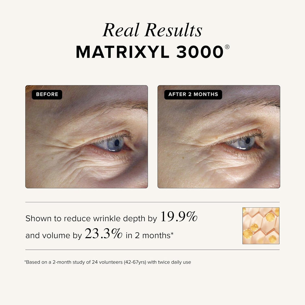 Asterwood Matrixyl 3000, Argireline Peptide, Vitamin C Cream - Triple Repair - with Hyaluronic Acid - Anti-Aging, Wrinkle Reducing, Hydrating - Fragrance-Free - 1.7 Fl Oz
